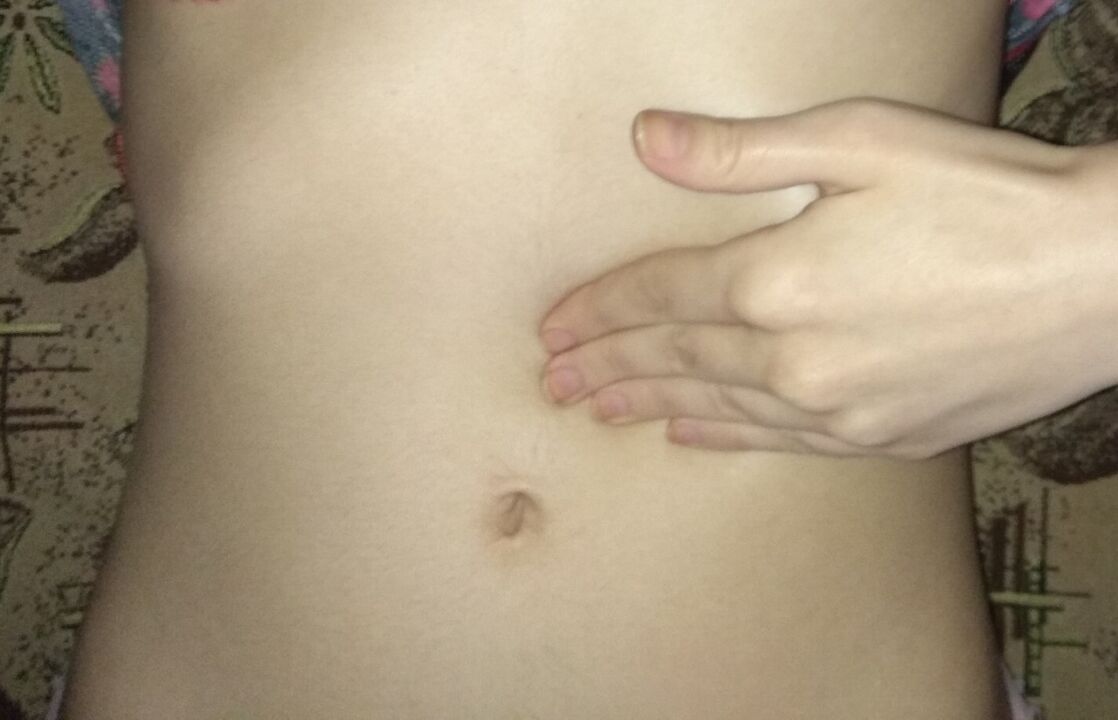 NEOflorax kapsülleri ile tedaviden sonra sağlıklı mide