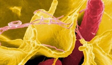 İnsan vücudundaki parazit belirtileri