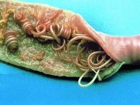 İnsan vücudundaki parazitlerin nedenleri