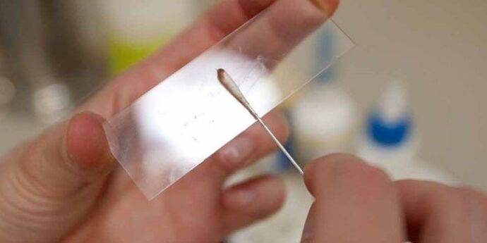 parazitler için deri kazıma