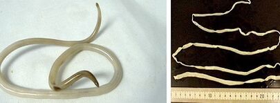 insan vücudundaki parazit türleri