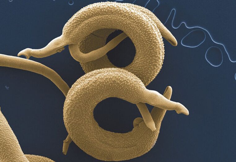 insan vücudunda yaşayan parazitler