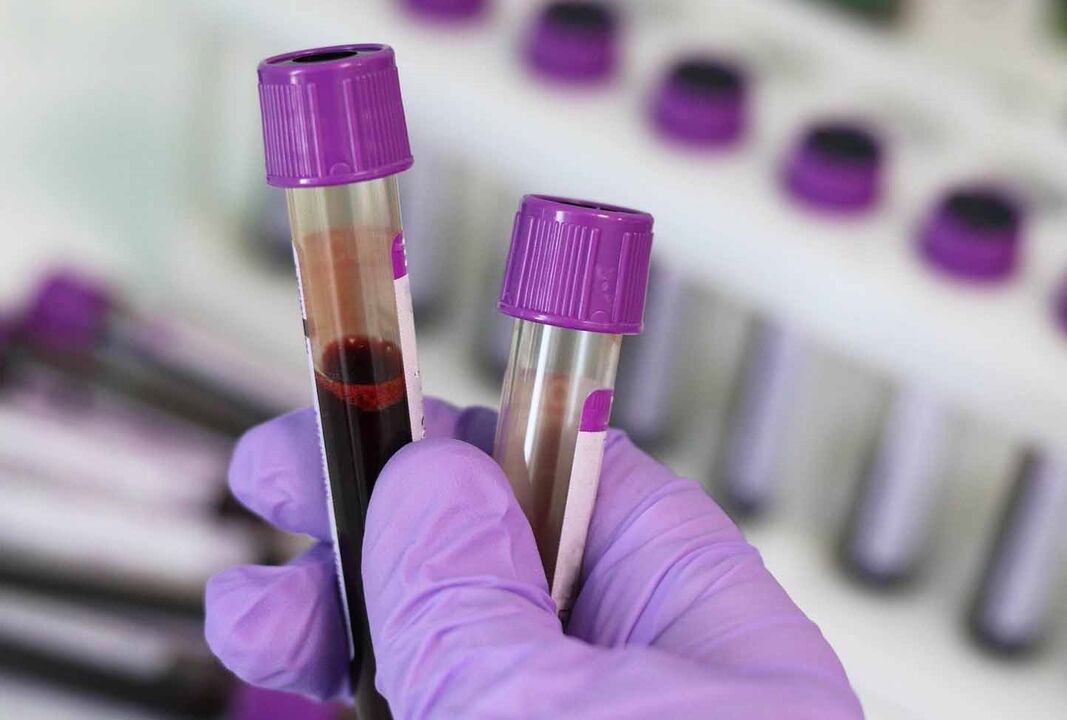 parazitler için kan testi